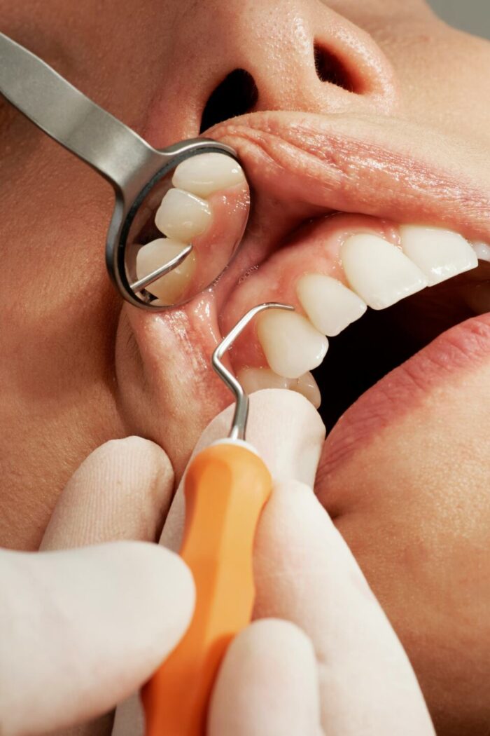 Top 10 Insider Secrets Behind a Flawless Grin